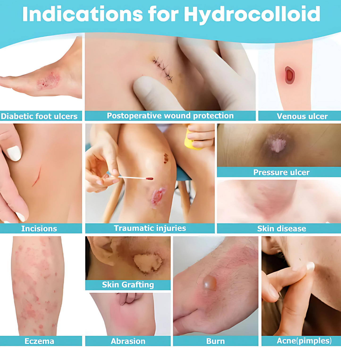 LumiPatch HydroCollid Roll Care