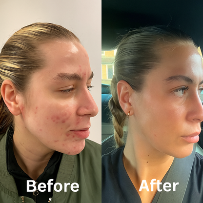LumiPatch HydroCollid Roll Care